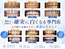 ホワイトニングショップ 葵区静岡駅店