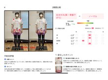 ティーシー(TC)/その日の姿勢変化（正面）AI評価