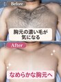 アルゴ 豊中岡町駅前店(ALGO) ビフォー アフター