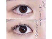 ビーティー(bT)/ラッシュリフト(まつ毛パーマ)