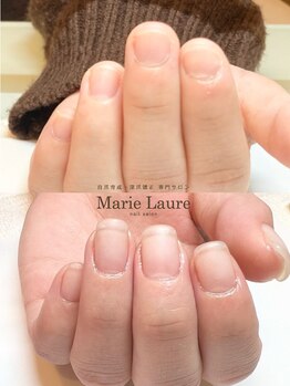 マリーロール 梅田店(Marie Laure)/自爪育成/深爪矯正/ネイルケア