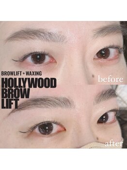 ベルダ(BELDAD)/ハリウッドブロウリフト