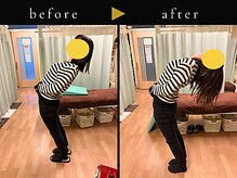 杉本接骨鍼灸院/腰の施術のために初めて