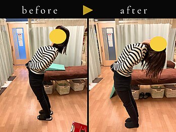 杉本接骨鍼灸院/腰の施術のために初めて