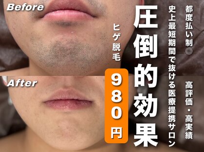メンズ脱毛サロン ボス(BOSS)の写真