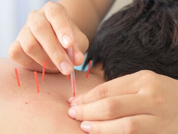 てんびん/鍼灸ですっきり♪