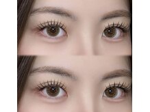 Lカールラッシュ