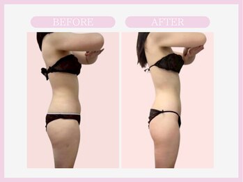 スリムライン 山形店(The Slim Line)/before→after