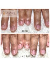 グレースレディ 大阪店/(深爪/長さだし/フィルイン)