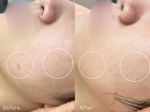 ミュー 栄本店(mieux)/お客様Before/After