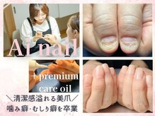 アイネイル(Ainail)