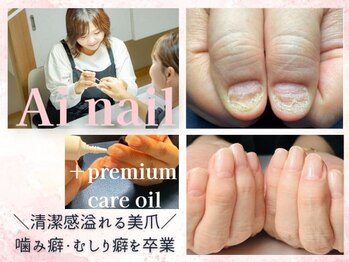 アイネイル(Ainail)
