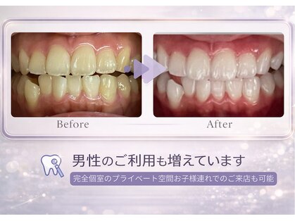エランホワイトニング 一社店の写真