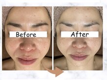 Lymph le ciel｜小顔たるみフェイシャル＆リンパマッサージ専門