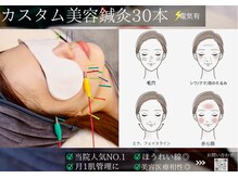 ミエリア美容鍼灸院(mielia美容鍼灸院)/◆↓カスタム美容鍼30本/電気有
