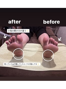リノ(LINO)/足つぼで内臓ケア♪