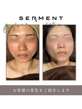 トータルビューティーサロン ヴィヴィエ(ViVier)/セルマン