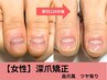 【お試し】女性●深爪矯正だと気付かれない自然な仕上がり自爪風￥23100→