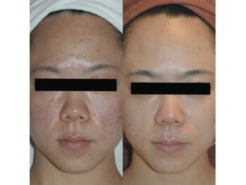 エイミー 名古屋駅前店(eimy.)/ララピール/名古屋