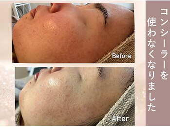 エヴァル(ewalu)/ー 3ヶ月の変化 ー