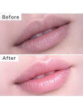 ルネル(Lunelle)/韓国式メラニンケア《唇》
