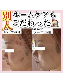 アルムダアクア 天王寺店(Aleumda AQUA)/