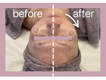 プルミエプラス 恵比寿店(PREMiER+)/【恵比寿/渋谷/小顔/たるみ】