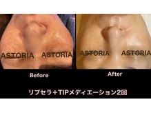 アストリア(ASTORIA)/しわとたるみに働きかける