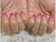 ヴィプラス(Vi+)/