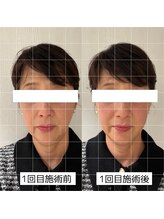 ヴィーライン 大阪梅田院(VeLine)/鍼灸／美容鍼／小顔／大阪／梅田