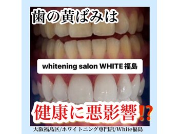 ホワイトニングサロン ホワイト(WHITE)/セルフホワイトニング/大阪/福島
