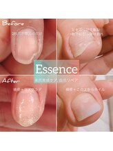 エッセンス (Essence)/自爪の割れ欠けも補修します◎