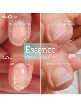 エッセンス (Essence)/自爪の割れ欠けも補修します◎