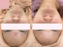 ミュー 名駅店(mieux)/お客様Before/After