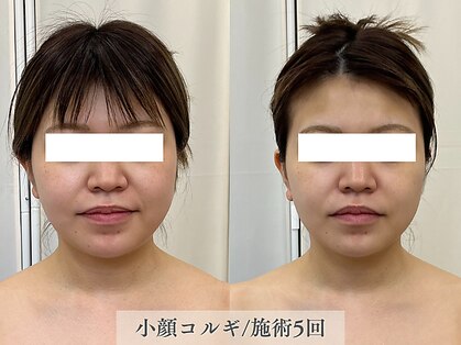 サロンディト(ditto)の写真
