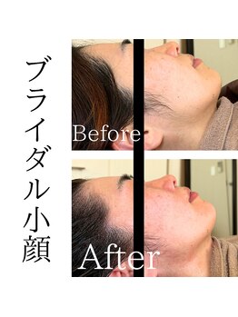 米香(MAIKA)/ブライダル60分/5回