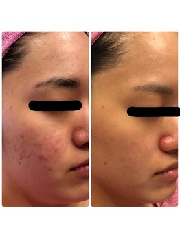 ワールドアイ(World. I)/肌質改善