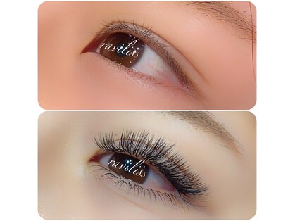 ラヴィリス(RAVILISS)の写真