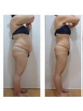 デイスパ ヴィータ/