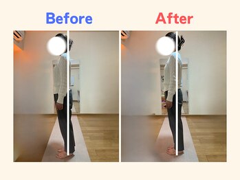 ピース/姿勢の歪みが気になる50代女性