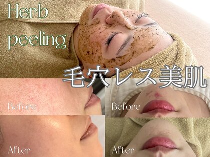 ティセ(TisseR)の写真