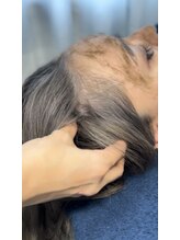 プリュボーテ 吉祥寺(Pul Beaute)/ハーブピーリング特徴 (５)