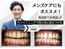 ベティー(Betee)の雰囲気（カウンセリングを行い、お客様のご希望に合わせたプラン提案）