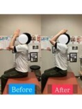 ナオル整体 宮崎院(NAORU整体)/30代男性施術事例【猫背改善】