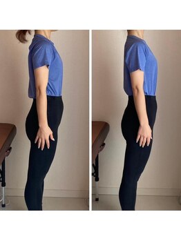 ザ エスアップ 博多店(THE S-UP)/施術前後写真