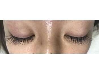 オランダエステティック(Holland Esthetics)/5,300. (5,830円税込)