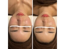 ジェニー(JENNI)/ララピール×LDM