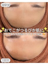 ベルファーム(Belle Femme)/ツヤツヤお肌に☆