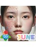 【6月限定】《毛穴ケア・肌質改善》REVIハーブピーリング¥9,900