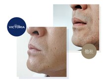 タスク(Tasuku.)/ヒゲ脱毛は、清潔感の第一歩